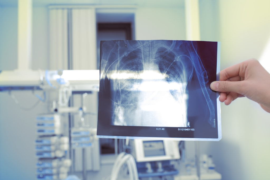 You could be at risk of silicosis