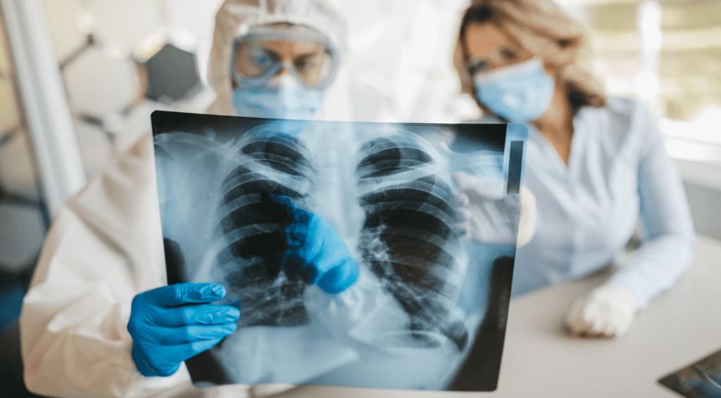 Silica Dust Risk - Silicosis
